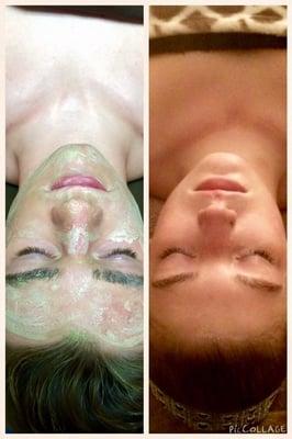 Teen Facials: for males and females. Specializing in acne treatments.