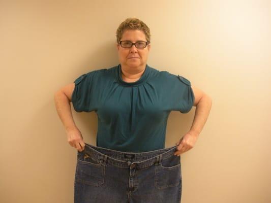 Lost 100 Pounds without surgery