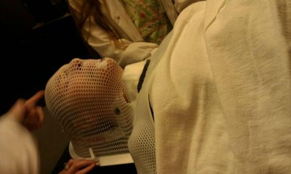 Mask to hold patient in place and for radiation markers