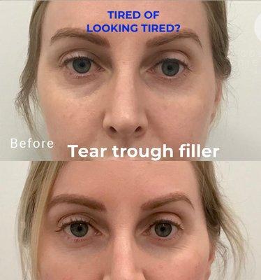 Tired of looking tired?