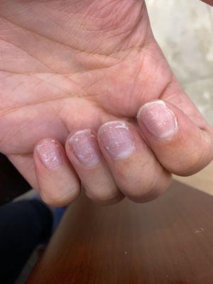 My natural nails after the woman I got painfully took off my acrylics WITHOUT soaking them or anything.