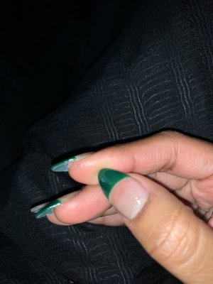 the finger she put nail glue on