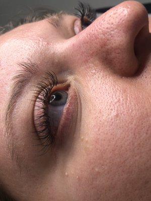 Eyelash extension