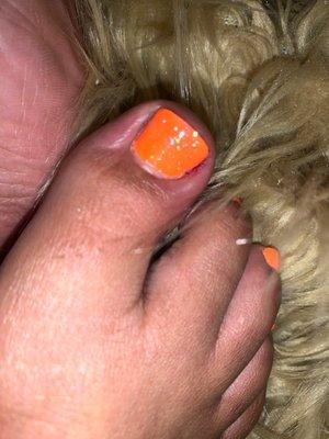 Picture of my big toe swollen from getting a pedicure here