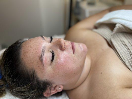 Post bride facial