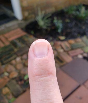 UNGLOVED thumb on top of it to wipe away bleeding cuticle. UNEVEN cut/shaped nails