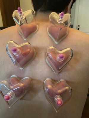 Pneumatic heart cupping available!