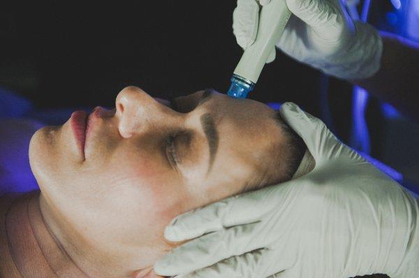 Hydrafacial treatment