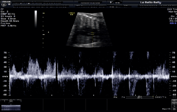 See and hear the baby's heartbeat.