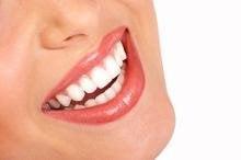 RightSmile Teeth Whitening in Schaumburg