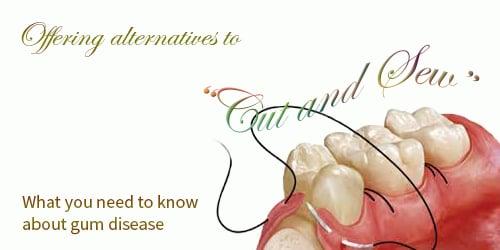 See us for non-surgical treatments for periodontal gum disease