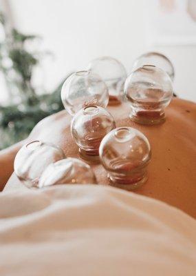 Fire cupping is a common modality to use for aches, pains, and relaxation