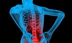 Reversing Chronic Back Pain