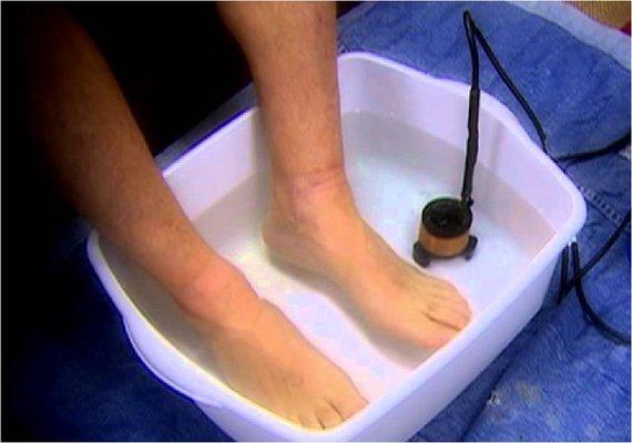 EB Pro Ion Foot Bath Therapy helps to remove many metals from your body.