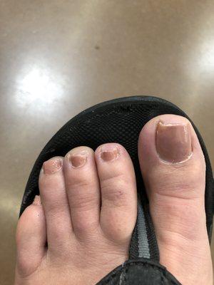 My toes immediately after my pedicure at Top Nails in Liberty Square, Teays Valley, WV. Worst pedicure I have ever had.