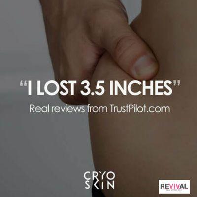 Mom Pooch? 
Saddlebags? 
Love Handles? 
Lose .5 to 4 inches per treatment!