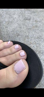 Horrible pedicure