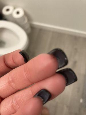 Thick clumpy nail glued to skin