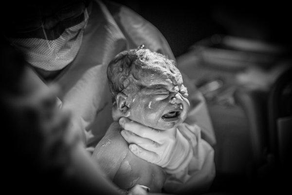 Birth Photography