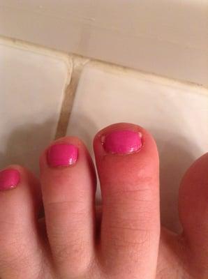 Infection day after visiting salon.  Puss coming out of both corners of the nail.  AVOID THIS PLACE LIKE THE PLEGUE!