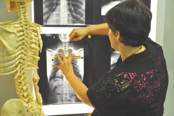 Dr. Sampair marking a patient's x-rays to prepare for specific adjustments to move the joints back into alignment.