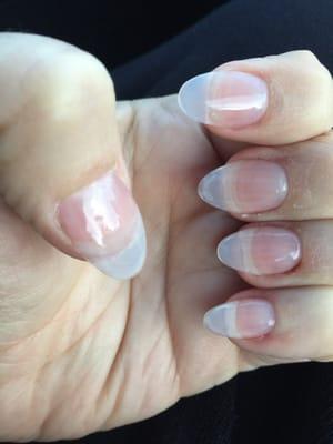 Bleeding on 3 nails,superglue skin under &on cuticles, dust hard under nails. Extra acrylic underneath.cracking and filed short!