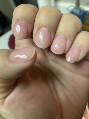 Uneven nail bed, HORRIBLE!