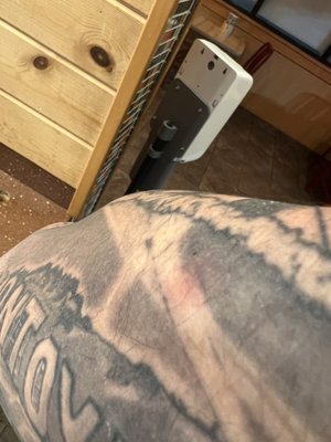 Bed bug bites kind of hard to see im heavily tattooed sorry but they were huge bites pictures do no justice