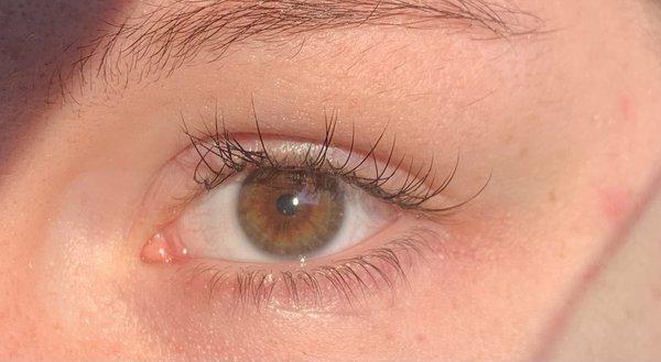 How crooked the eyelashes were placed, and how there are gaps of hair loss since the clusters have begun to fall out.