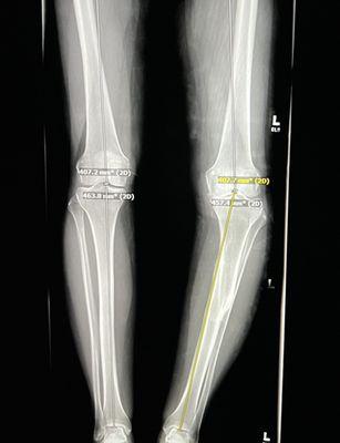 X-ray