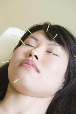 Experience the beauty-enhancing effects of cosmetic acupuncture.