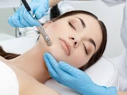 Microdermabrasion Facial