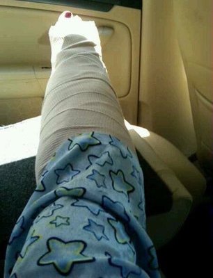 Long ride home from ER in heavy gigantic splint