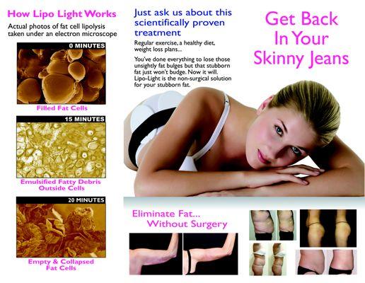 Eliminate fat without surgery!! Call now for an appointment to avail our summer promotion!