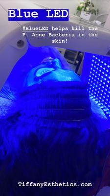 Blue LED Light Therapy to kill the P. Acne Bacteria in the skin! HydroJelly Mask + Eye Mask + Lip Mask