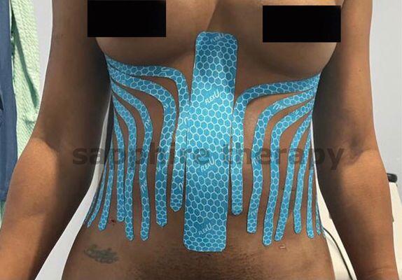 Kinesio Tape for Lymphatic Drainage