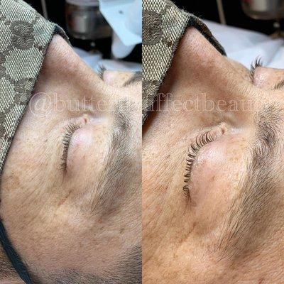 Before Vs After Lash Lift