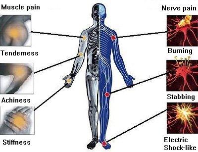 #Acupuncture4Pain #NaturalPainRelief