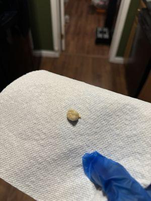 Tooth that was found in taffy