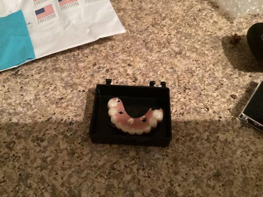 Destroyed my teeth drilling holes in them.  Insurance never seen the teeth.  They were paid cash back in 2018 to a different dentist.