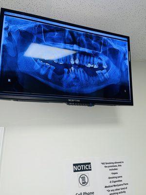 X-rays on screen.