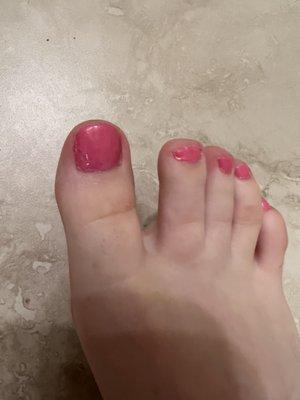 Terrible pedicure