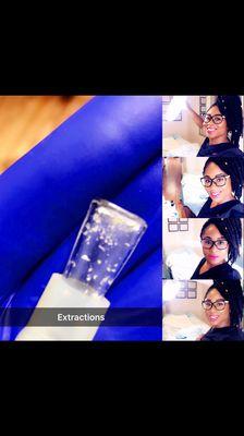 Extractions