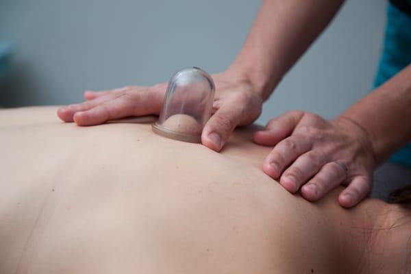 Soft Tissue Cupping