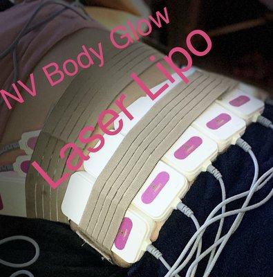 Laser Lipo