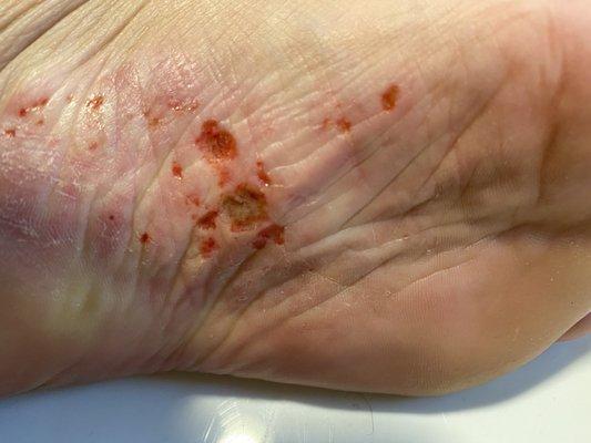 My foot after a pedicure at LV nails