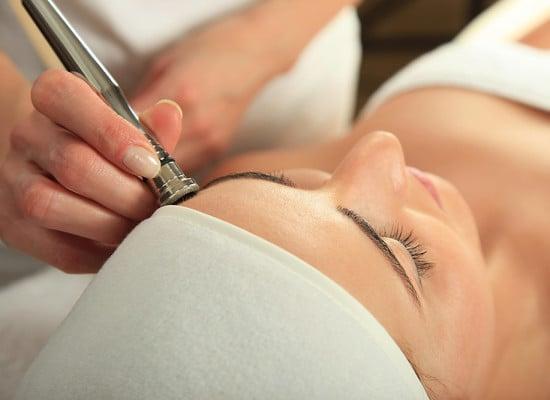 Microdermabrasion