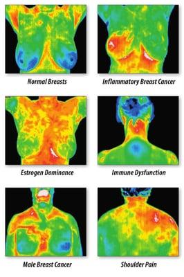 Various thermal findings