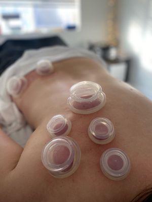 Cupping session