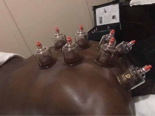 Cupping session